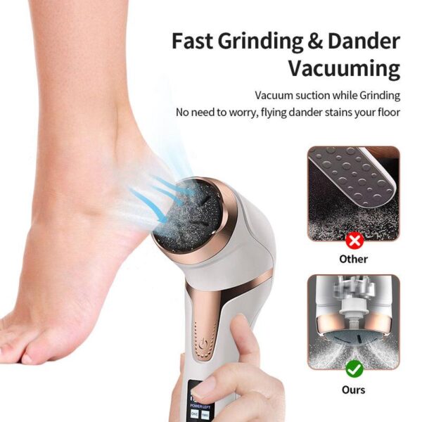 Electric Foot Dead Skin Remover - Image 2