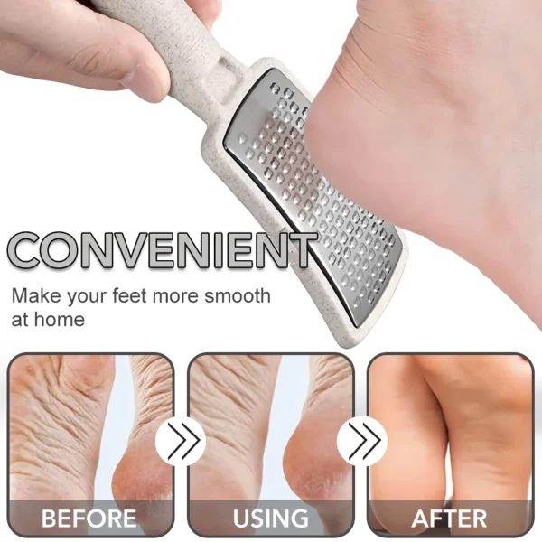 Stainless Steel Foot File Callus Remover with Dead Skin Storage - Image 2