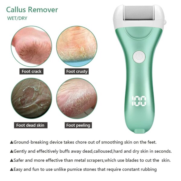 USB Rechargeable Electric Pedicure Foot File - Image 2