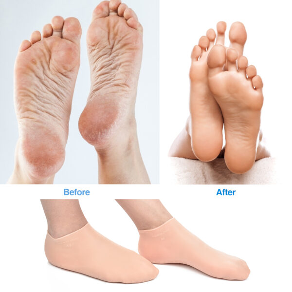 Silicone Gel Moisturizing Socks - Image 2