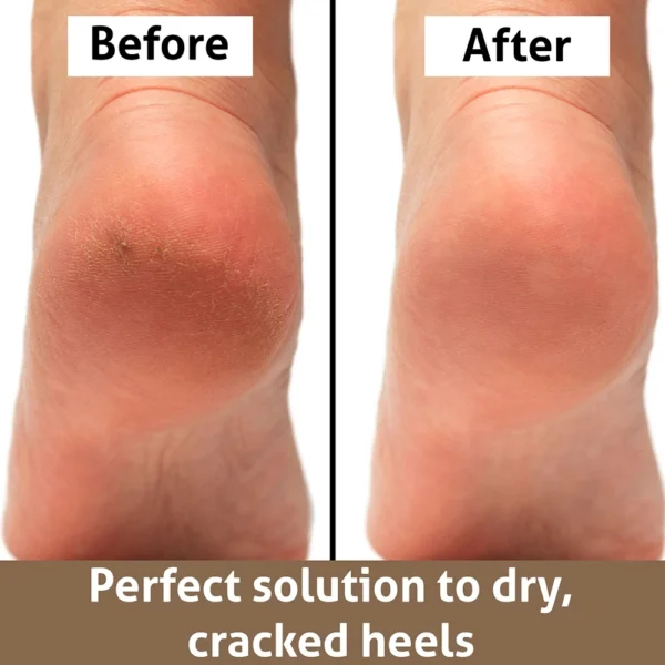 Golden Foot File Rasp for Callus Removal - Image 3