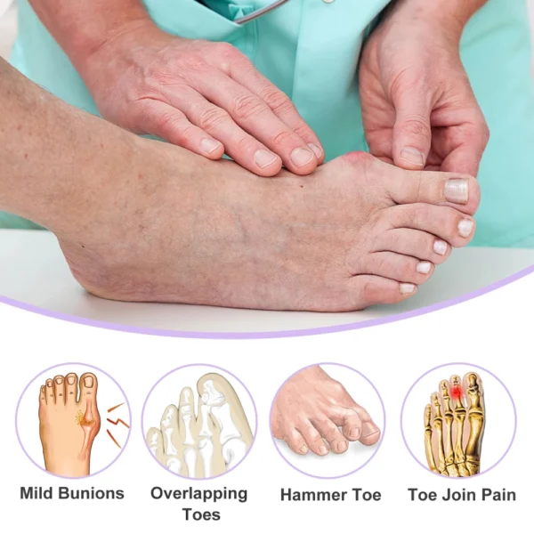 8PCS Silicone Toe Separators for Foot Care and Pain Relief - Image 4