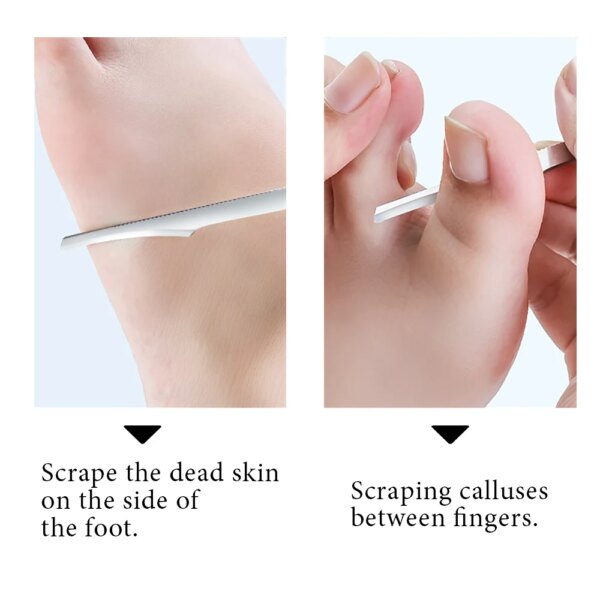 Stainless Steel Pedicure Knife Set - Image 2