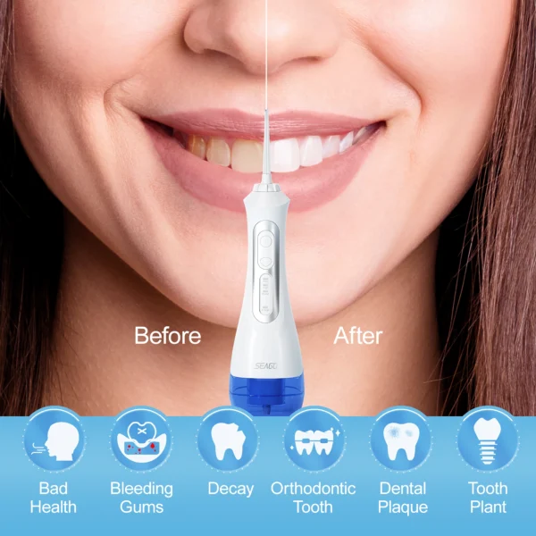 Portable Water Flosser — USB Rechargeable With 3 Modes - Image 3