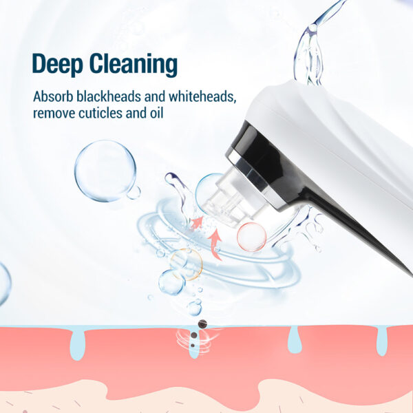 Electric Pore Vacuum & Blackhead Remover - Image 6